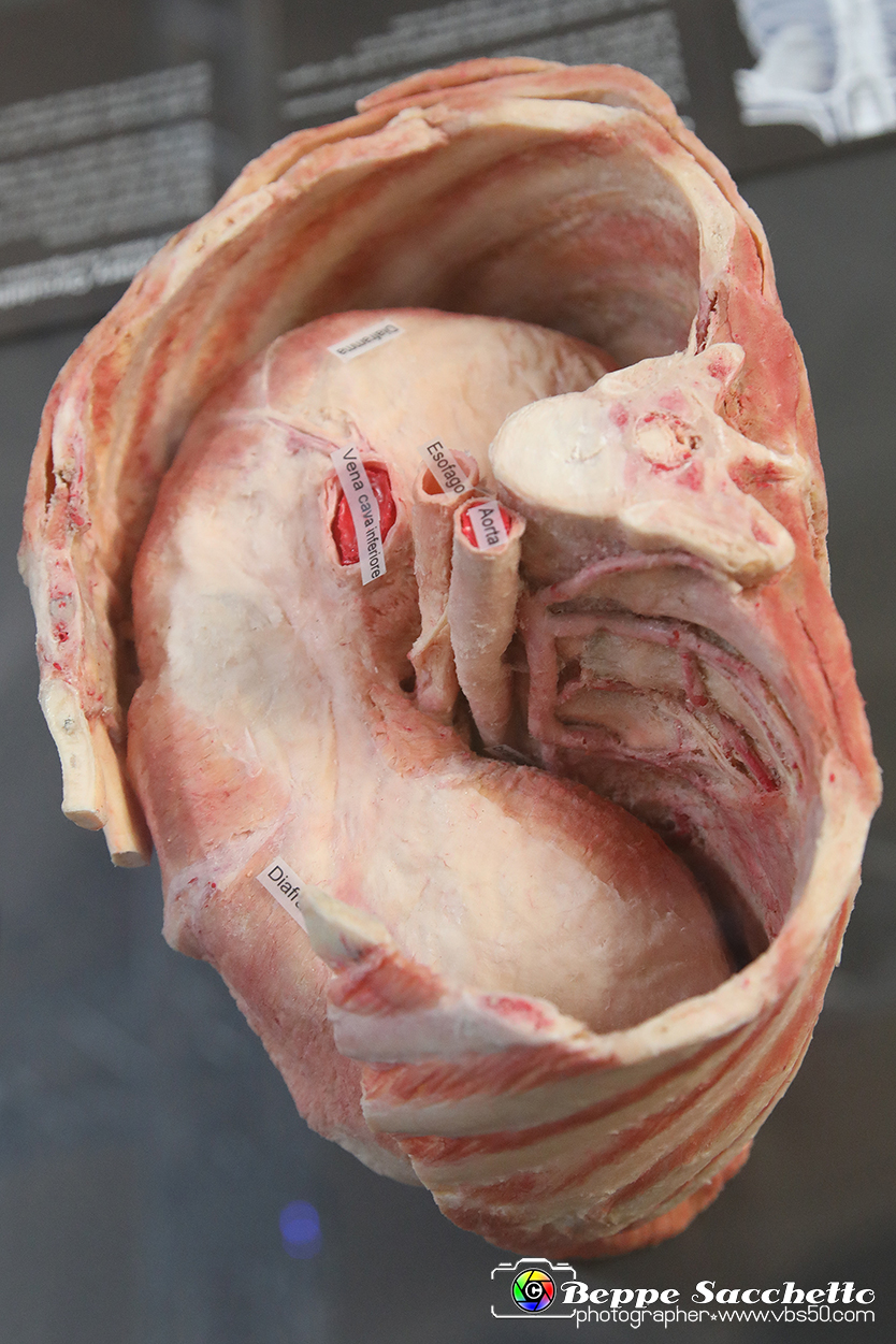 VBS_2650 - Torace con diaframma - Mostra Body Worlds.jpg